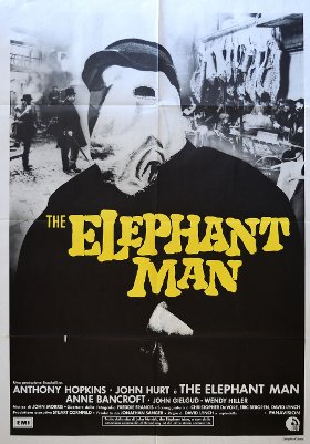 Elephant man